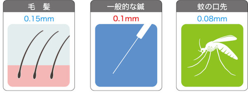 肩こりに鍼が効くってホント 鍼治療と肩こりの関連を解説 鍼灸院予約 検索サイト 健康にはり